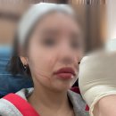 프라임킴 | 강남역피부과 울쎄라피프라임 킴카다시안이 다녀온 병원 다녀온 후기