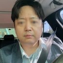 색소침착관리 &amp; 엑셀브이후기, 잠실 피부과 솔직 시술 후기