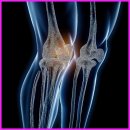 코코아이성형외과의원 | 근육경련, 쥐 나는 이유와 해결법