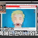 의사가 수술 게임을 리뷰 한다면?? [편도 수술 생중계] 개웃김 ㅋㅋㅋ 이미지