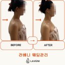 라베니 | [대구신부관리 추천] 수성구피부관리 라베니, 얼굴·목·어깨까지 달라진 후기