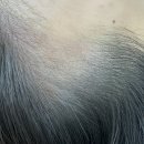 씨유 강남거평타운점 | [서울 강남 두피문신 ]살롱드예노 :: SMP관리로 M자 헤어라인교정 전후사진 (1차)