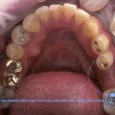 덴탈아트치과기공소 이미지