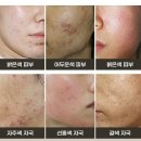 후한의원 네이버블로그