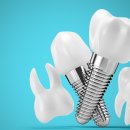 정연합치과의원 이미지