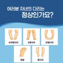 연세보조기 이미지