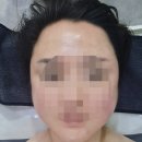 동안에스테틱 - 산청군 | 영등포 피부관리 추천 샤인 에스테틱 동안관리 후기