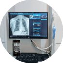 하이의원 | [하이메딕 설치후기/신규도입] ○○이비인후과의원 SNRT 포터블 엑스레이(ULTRAY90)