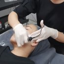 MTS 효과 주름,모공,탄력,건조함 한번에 잡아주는 피부재생관리 대구더제이비에서 받아본 후기