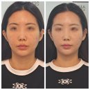 작은꽃지천 | 강남역작은얼굴 강남뷰티 매직 작은얼굴관리 예신관리 후기 추천