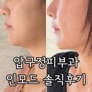 떡두꺼비 - 안산시 상록구 본오로 136-1 | 압구정역피부과 인모드 FX +FORMA 얼굴전체 내돈내산 비용 후기
