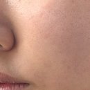 초이스짐 | 김포 구래 모공관리 잘하는 곳 초이스뷰티 후기