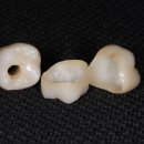 민치아치과기공소 이미지