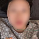 해바라기한의원 | 개포동 속편한한의원 다이어트 8주차 - 정안침, 지방분해침 후기