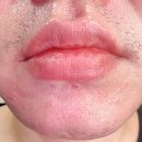 씨앤씨환경 | 수유역 왁싱샵 씨앤씨왁싱 수유점, 인중 제모 깔끔 후기