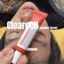 한이븐(주) | 이븐스킨 피지완화제 :: 오돌토돌 피부와 블랙헤드 집중 관리 후기