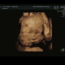 문현이마트 아가방 | 임신 26 ~ 30주차(+임당검사,입체초음파)