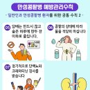 만성 이미지