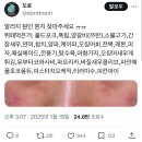 [내돈내산 후기] 양준상의원 | 디컨타미네이션의 증인