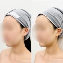 효일2 | 야탑 윤곽관리전문 ‘효에스테틱’ 에서 윤곽&amp;수분관리 받은 후기
