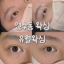 유월왁싱 | 연수구 피부관리 유월왁싱 눈썹왁싱 후기