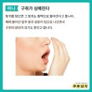 방귀를 참으면 안되는 이유~ 이미지