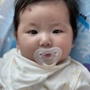 아이엠피부과의원 | 아기 혈관종 치료 후기 1탄 | 티모프틱으로 치료 중