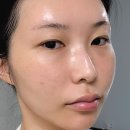 필노래 | 천안왁싱 토티왁싱에서 물광소개팅필 받고 얼태기 극복하고온 후기