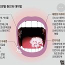 나 입병 궁금한거잇는네 이미지