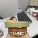 위스마일치과교정과치과의원 | 울산 치아교정기 잘하는 곳 위 스마일치과교정