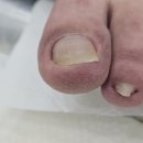 내 손으로 담그는 우리집 전통장 | [인천내성발톱 / 연수구내성발톱] 숨겨진 발끝의 비명, 방치가 불러오는 전신 불균형과 전문 샵 교정...
