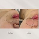 리누에스테틱 이미지