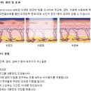 오라클피부과 이미지