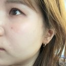 강남-245 | 강남역미인점 중앙부축소 재물점 내돈내산 강추 후기