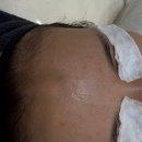 숨에스테틱왁싱 | [구월동피부관리] 지긋지긋한 트러블 안녕!｜조이왁싱&에스테틱에서 진정 관리받은 후기