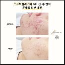 더스무스스킨케어&왁싱 네이버블로그