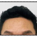 모디헤어플란트의원 이미지