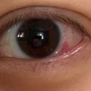 우안과의원 이미지