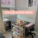 [인천-논현]다시 찾아간 피부샵 내돈내산 소녀피부 등관리 후기