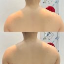 목중`대성로 | [에스테틱] 청주 웨딩관리/청주 윤곽관리 추천. 수기관리 맛집.승모근, 라운드숄더 교정엔 청주 후광미인