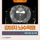 24시 더휴동물의료센터 | 부산 강아지 뇌수막염 치료 후기 강아지 발작 경련 mri [24시 더휴동물의료센터]
