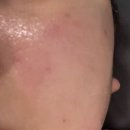 로덱스앤리버스 | 양주 옥정 바디관리 피부관리 로덱스스킨앤왁싱