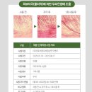 (주)이오바이오 | 두피가 편안해지는 시간 모발두피케어 추천 템 이오 포미나 샴푸 솔직 리뷰