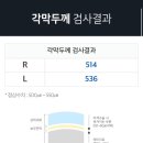 디옵터 이미지