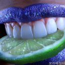 정다운치과의원 네이버블로그