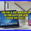 자주고름 | 고름 터질 것 같은 화농성 여드름, 3일 만에 사라진 비법 공개! (피부과 직전 가이드)