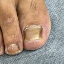 네일디바&레푸스 건대점 | 건대 뚝섬역 발톱무좀 내성발톱 복합관리 받았어요 네일디바&amp;레푸스건대점