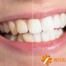 밝은마음치과의원 이미지