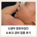 건영약국 | 신생아 1개월 영유아 검진 &amp; BCG 경피용 접종 후기 (똑닥 영유아검진, BCG 경피 비용, 접종 주의사항)