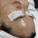 광주 여드름관리 파메스테틱전문 고민정피부연구소 슈퍼젝션 후기